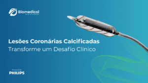 Lesões Coronárias Calcificadas: Transforme um Desafio Clínico