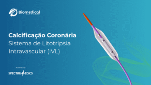 Calcificação Coronária Sistema de Litotripsia Intravascular (IVL)